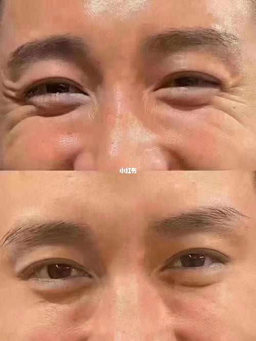 鱼尾纹面相分析