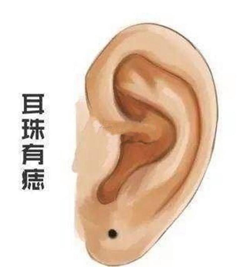 耳珠有痣代表什么
