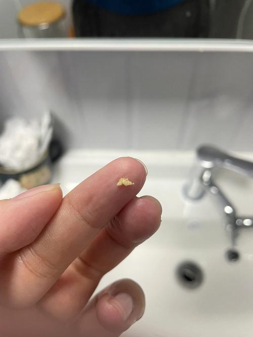 梦到牙齿碎成小渣渣是什么意思