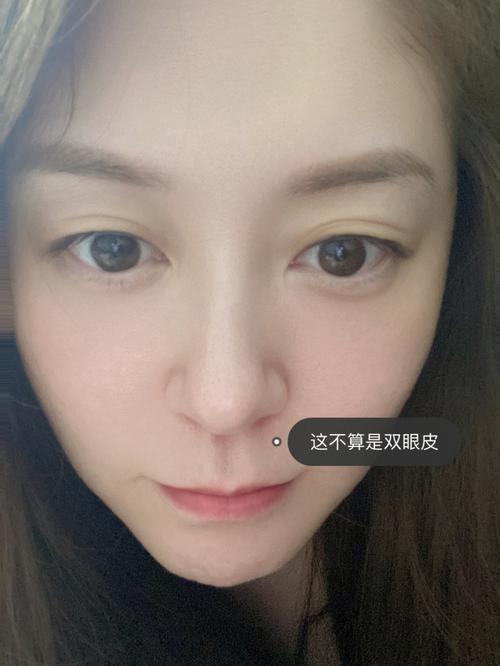 梦见别人割双眼皮,做双眼皮的危害都有哪些该怎么避免