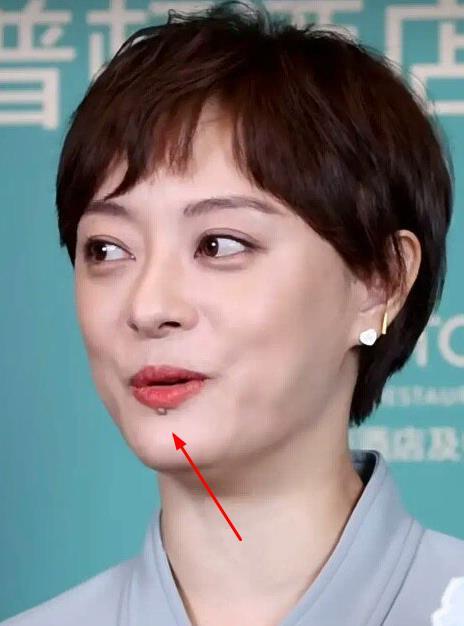 女人下嘴唇后天长痣位置