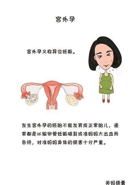 梦见宫外孕暗示什么