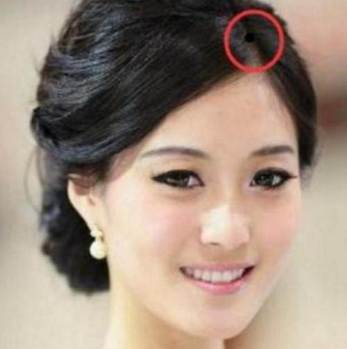 女人克夫痣真的克夫吗