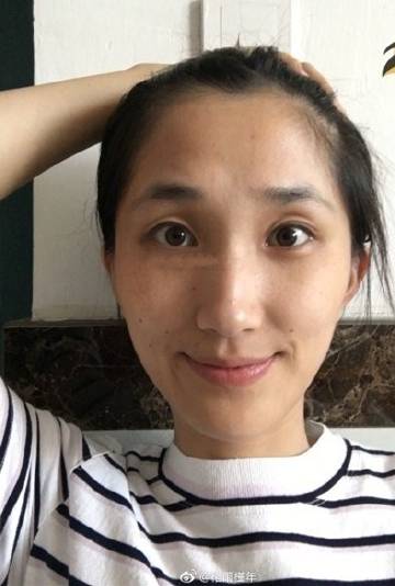 女人额头中间有竖凹陷