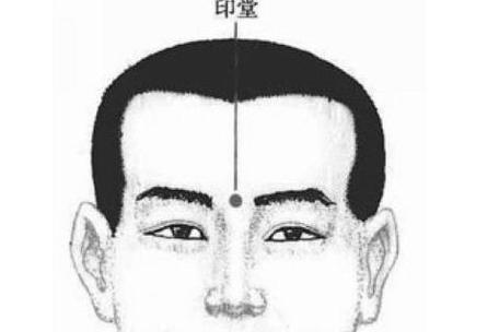 印堂发亮是吉兆吗