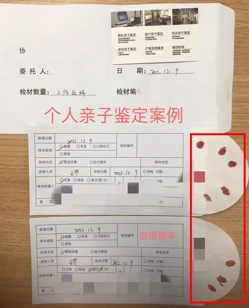 做亲子鉴定需要本人吗