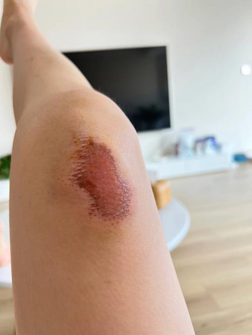 梦见骑车摔倒,工作生活出现障碍