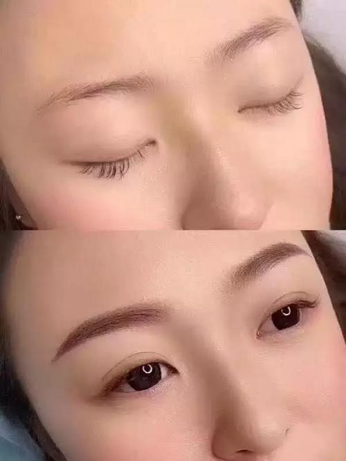 天价转运眉有效果吗