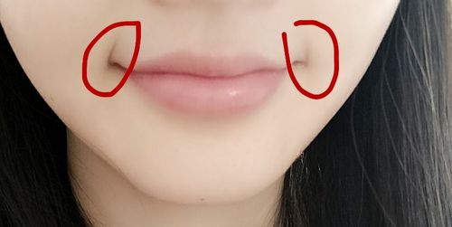嘴角的纹叫什么