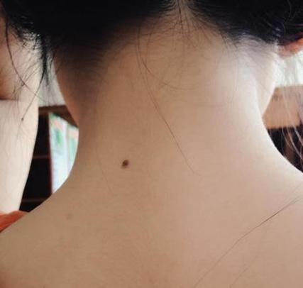 脖子后面有痣的女人好不好