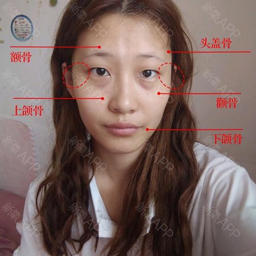 脸颊两侧骨头很突出