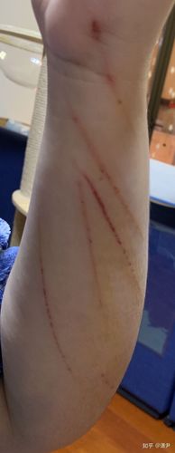 梦见自己被猫抓伤了脚