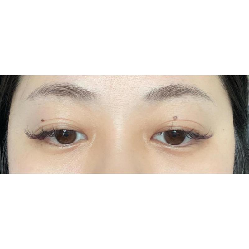 女左双眼皮上有痣怎么样