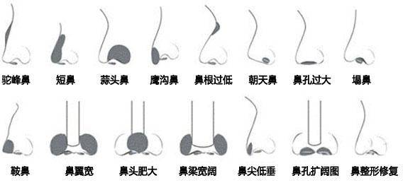 30种鼻相与对应信息看你的鼻子准不准