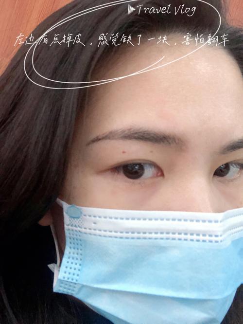 眉上长毫十年必死吗
