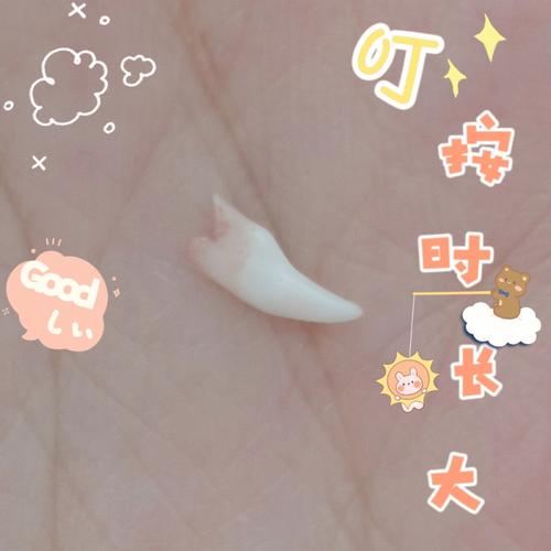 梦见自己虎牙掉了