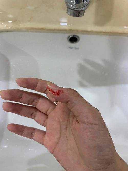 梦见螳螂咬自己