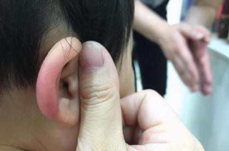 耳朵烫是什么预兆
