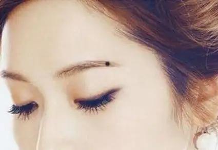 女生眉毛上长痣