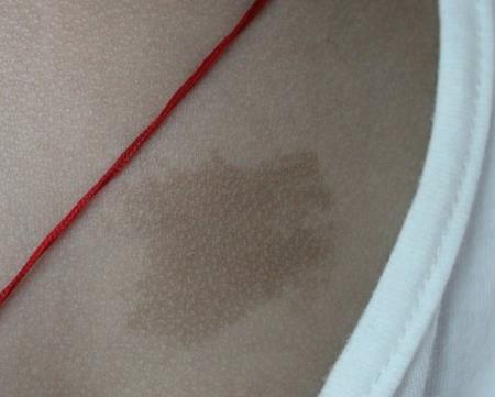 痣相分析腿上有胎记的男人命运:一生波折,奔波劳累?