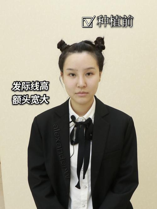拥有美人尖的女生能够嫁有钱人吗