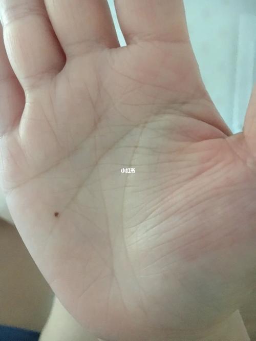 手心有痣的女人婚后能掌握财政大权吗