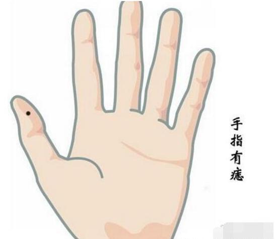 男人有苦情痣会命苦吗,对一生命运到底是好是坏?
