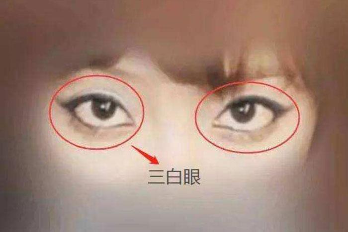 三白眼是纵欲过度的表现吗