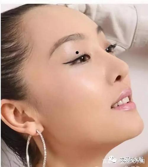 痣相中的招财痣
