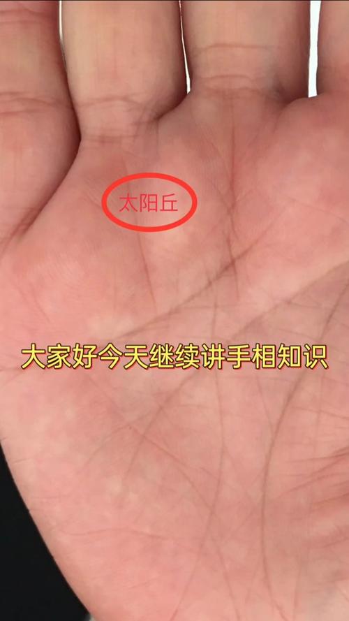 太阳丘凹陷的人命苦吗