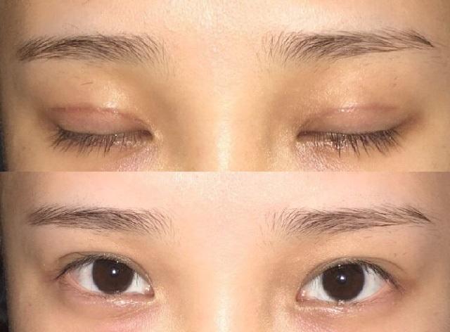 割双眼皮会不会影响命理