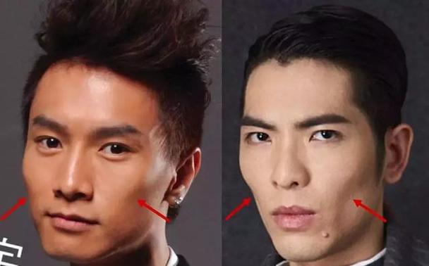 颧骨与男性的关联