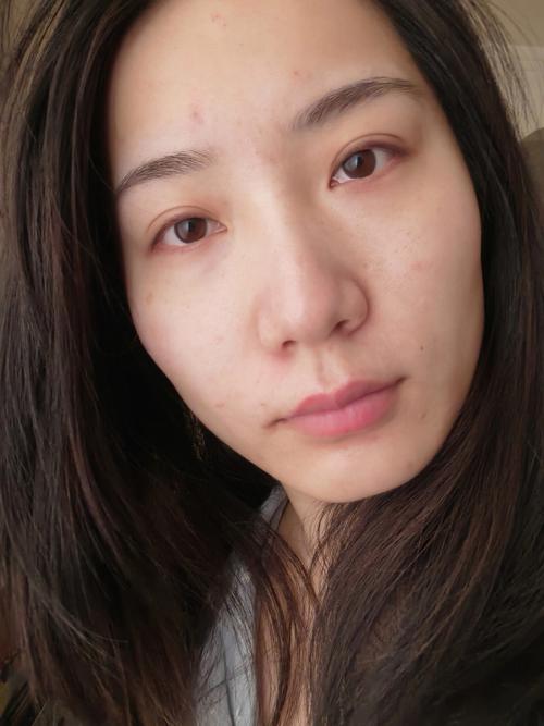 菱形脸的女人有胎记会克夫吗