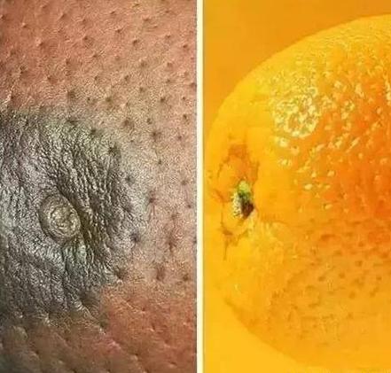 梦见乳房流血是什么意思