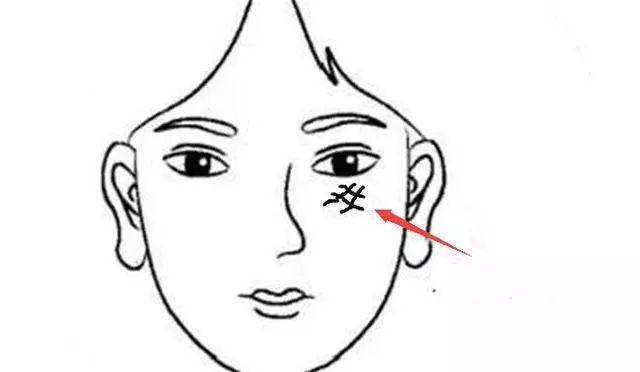 泪堂有井字纹与子女缘分浅是真的吗