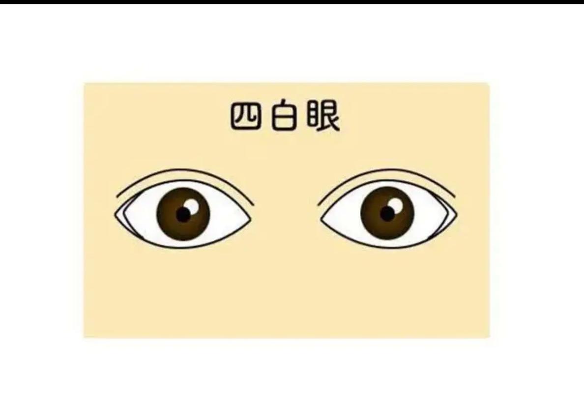 主凶眼型之四白眼