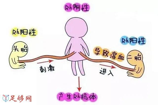 夫妻血型不合造成不孕