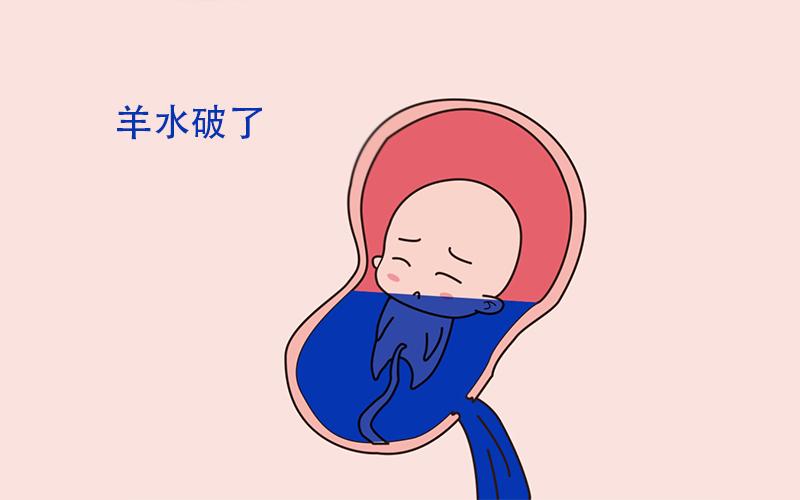 梦见羊水破了