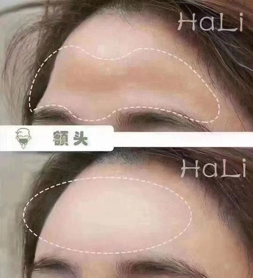 额头窄是不是代表以后没福气