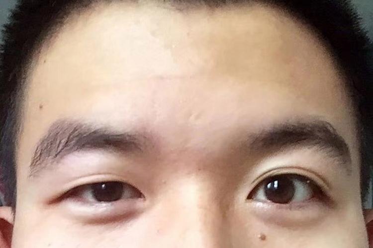 男生大小眼有什么说法
