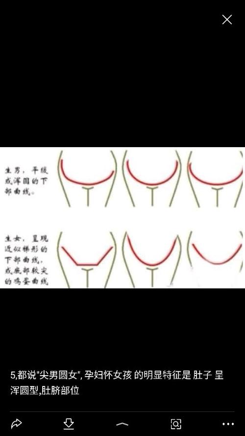 生男孩的妊娠线图解