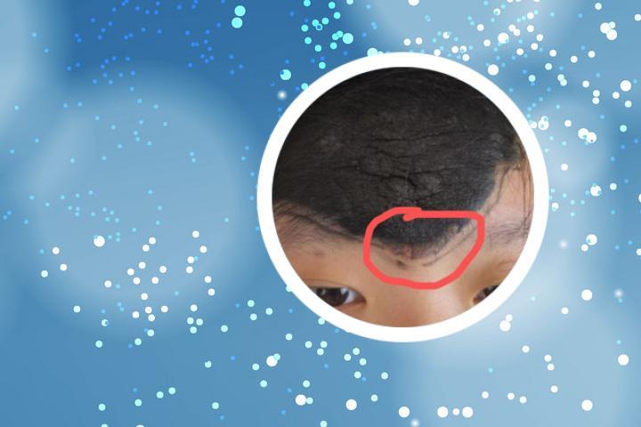 胎记长在嘴唇上好吗