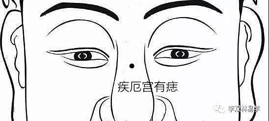 破军星在疾厄宫