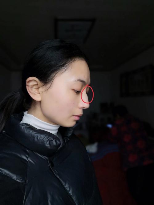 鼻子看相:驼峰鼻是怎么回事
