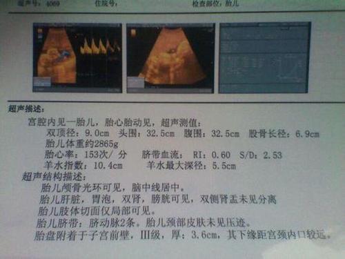梦见做b超是男孩是什么意思