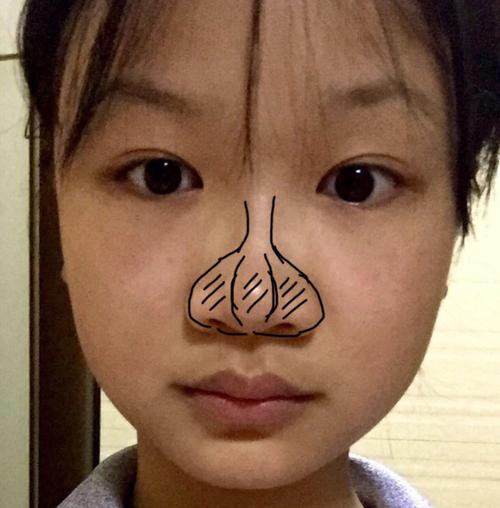 蒜头鼻面相怎么看