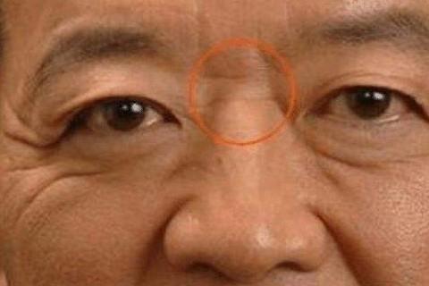 男人鼻梁有横纹的面相分析