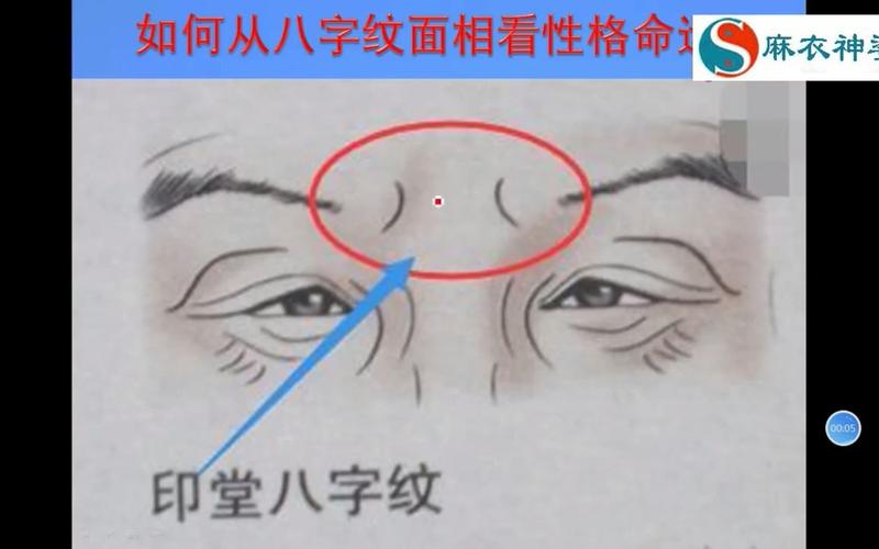 印堂八字纹的男人面相