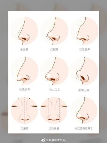 剑锋鼻和鹰钩鼻的区别
