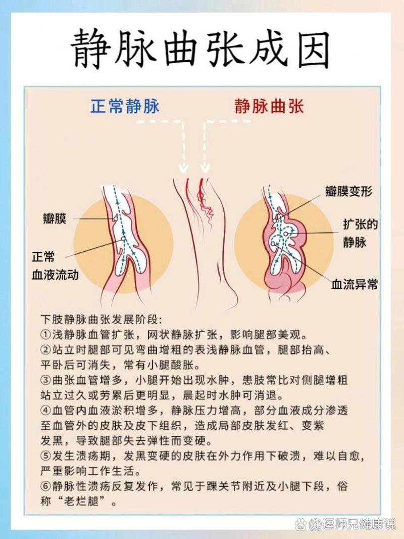 梦见静脉血管好吗